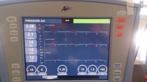 DSC_0926 Avea initial setup